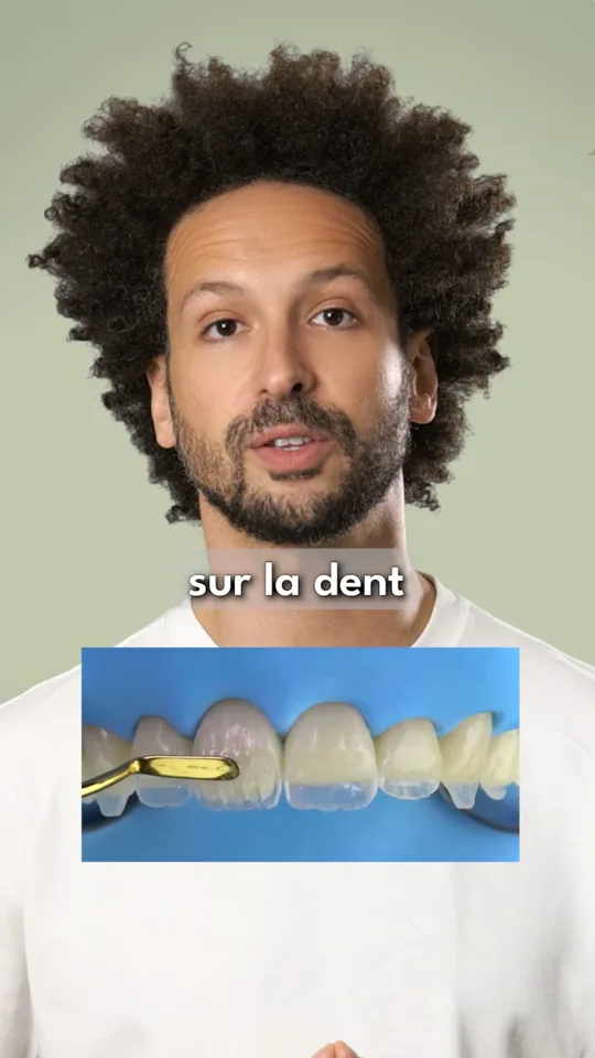 Composites esthétiques — FAQ Dr Bruno Abehassera
