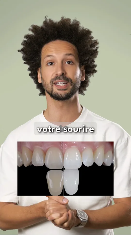 Éclaircissement dentaire — FAQ Dr Bruno Abehassera