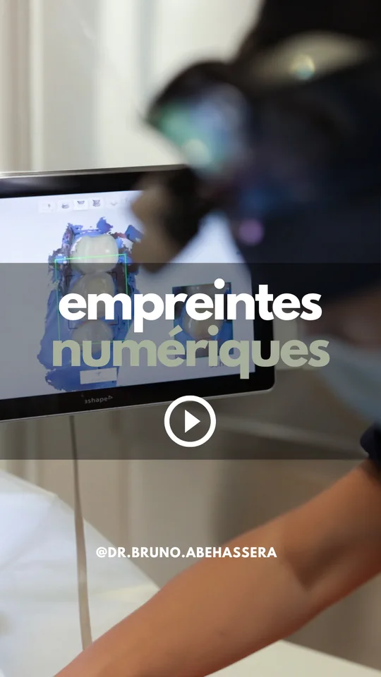 Le scanner intra-oral