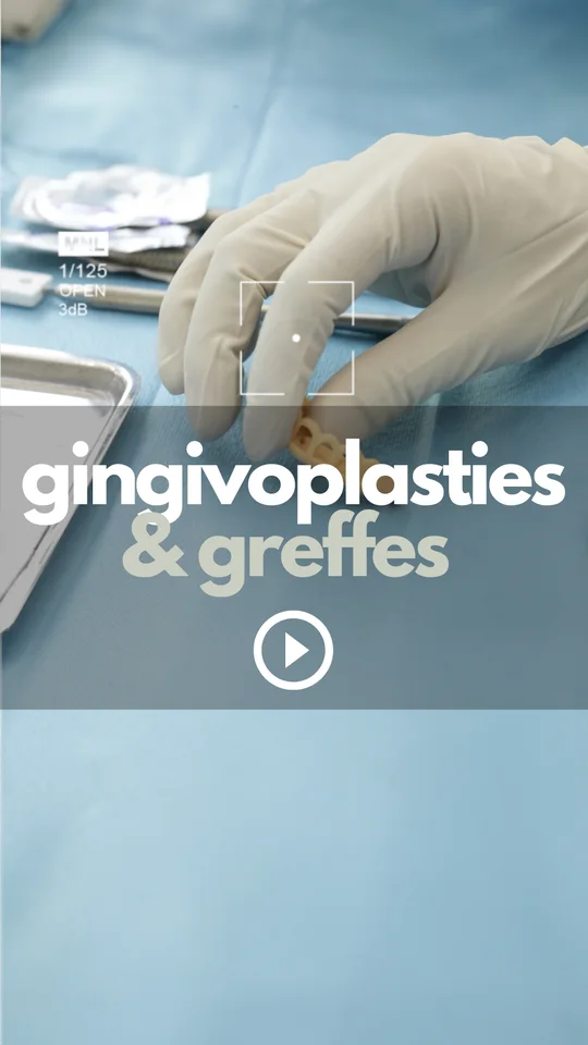Gingivoplasties et greffes de gencive